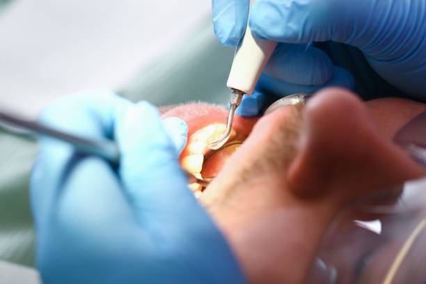 Best Knocked-Out Tooth Emergency  in Earlham, IA